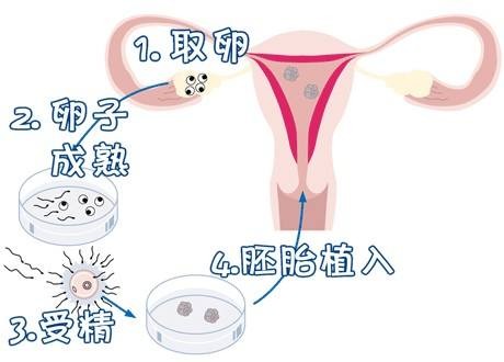 冷冻存储